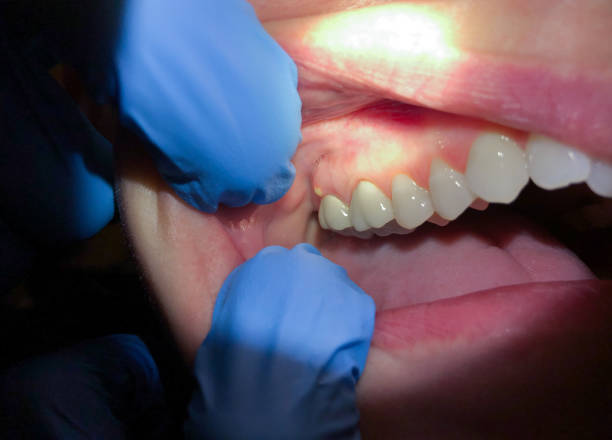Best Broken Tooth Emergency  in Highland Village, TX